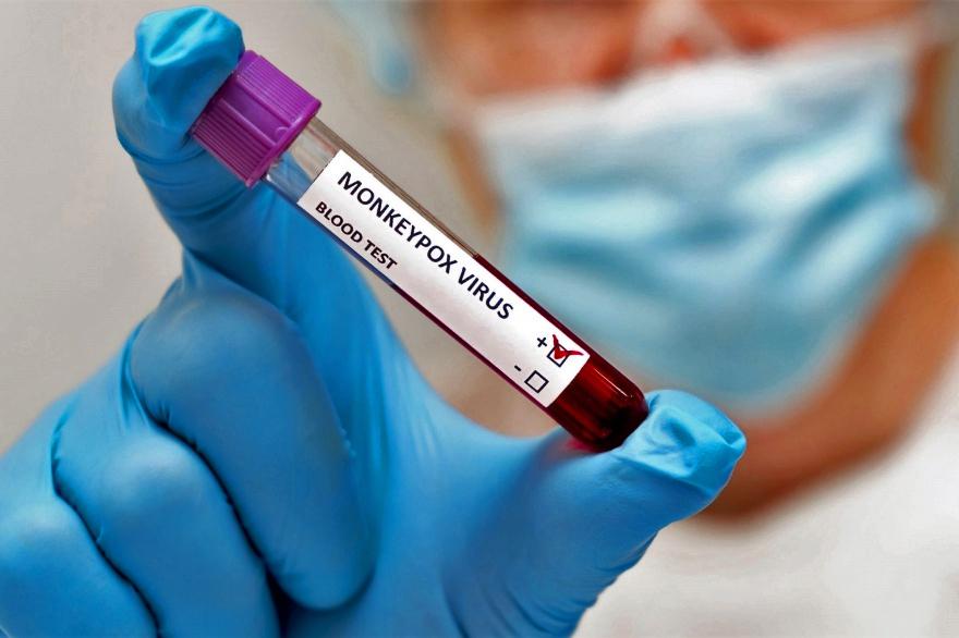 viruela-simica-test-generico